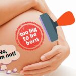 Copy of Copy of too big to be born___
